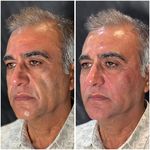 مطب زیبایی لیانارخ