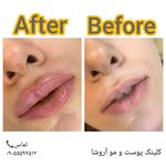 مرکز زیبایی,بوتاکس و لیزر آروشا