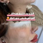 مرکز لیزر و کلینیک زیبایی پریفا