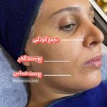 فیشال تخصصی  سعیده صدیقی