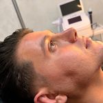 مرکز جراحی زیبایی بینی