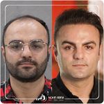 کلینیک پوست مو و زیبایی نوین ایرانا