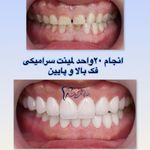 دندانپزشکی آریان بیمه تکمیلی با بیهوشی