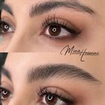 میکروبلیدینگ و شیدینگ مینا حسینی