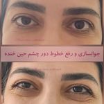 کلینیک زیبایی و لیزر مایا (دکتر وحیدی)