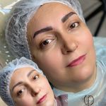 خدمات تخصصی آرایش دائم و ریموو فرشته حمیدی