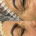 خدمات تخصصي پوست و تيرگي هاي بدن محبوبه