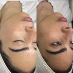 خدمات تخصصی فیشیال آیسو