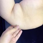 کلینیک زیبایی الماس کاملا اقساطی