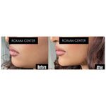 کلینیک پوست مو و زیبایی رکسانا