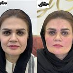 کلینیک پوست و زیبایی ولاغری تاج عظیمیه