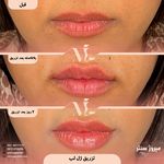 مرکز پزشکی و زیبایی میروژ سنتر