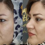 کلینیک زیبایی الماس کاملا اقساطی