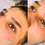 کلینیک زیبایی دریا/دکتر امیر قهرمانی