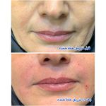 کلینیک زیبایی آفرینش،دکتر مهدی قهرمانیان