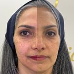 کلینیک پوست و زیبایی ولاغری تاج عظیمیه