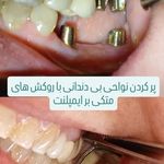 مطب دندانپزشکی دکتر فاطمه محمودی افصح
