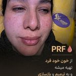 نوبت‌دهی آسان دکتر سید ابوالفضل کمانی، متخصص پوست و مو و زیبایی شیراز - شیراز - 6923