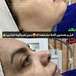 فیشال تخصصی  سعیده صدیقی