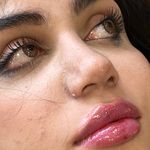 کلینیک پوست سلین - کلینیک پوست و مو - شهر شیراز - 0030