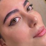 میکروبلیدینگ فیبروز تخصصی