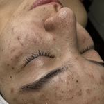 پاکسازی پوست و مو مهسام
