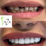 دندانپزشکی دکتر آزاده خلجیان