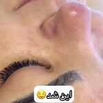 خدمات تخصصی پاکسازی پوست صورت و بدن