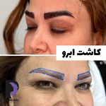 کلینیک زیبایی پوست و مو و لیزر پامچال