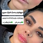 کلینیک زیبایی و پوست دکتر سورین
