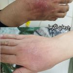 فیشال درمانی و پاکسازی پوست میرجلیلی