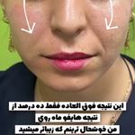 کلینیک لیزر و زیبایی ماهروی