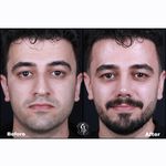 دکتر بهروز جلالی (جراحی بینی لیفت صورت)