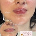 مرکز لیزر ،پوست و زیبایی کندی بیوتی