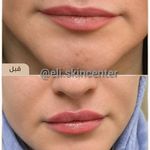 مطب زیبایی دکتر ملکی