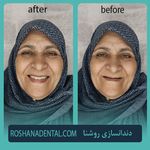 لابراتوار دندانسازی روشَنا