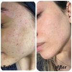 خدمات تخصصی فیشال سارا اسکین بار