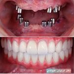 مركز دندانپزشکی دکترفرنوش عیوضی