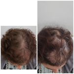 کلینیک هانیل | فیلر و بوتاکس شرق