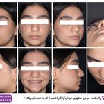 رادیولوژی و سونوگرافی گاما