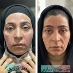 کلینیک زیبایی و لیزر دکتر آزاده اسماعیلی