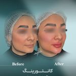 مطب پوست زيبايی ليزر دکتر شاه نعمت الهی