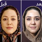 کلینیک زیبایی الماس کاملا اقساطی