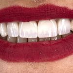 خدمات دندانپزشکی دکتر زهرا خلیلی