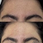 فیشال و پاکسازی پوست  آیلار شاهوردی