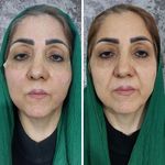 کلینیک زیبایی دکتر فاطمه کوچالی