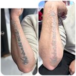 کلینیک لیزر  کندلاوزیبایی پوست ومو آیشیل