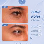مطب زیبایی و لیزر دکتر امیرحسین متوسلیان