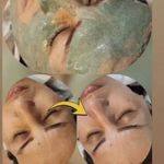 کلینیک تخصصی فیشال واسکراب اسکالپ مهرو