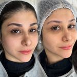 مرکز تخصصی فیبرز ابر‌و حمیده رحیمی